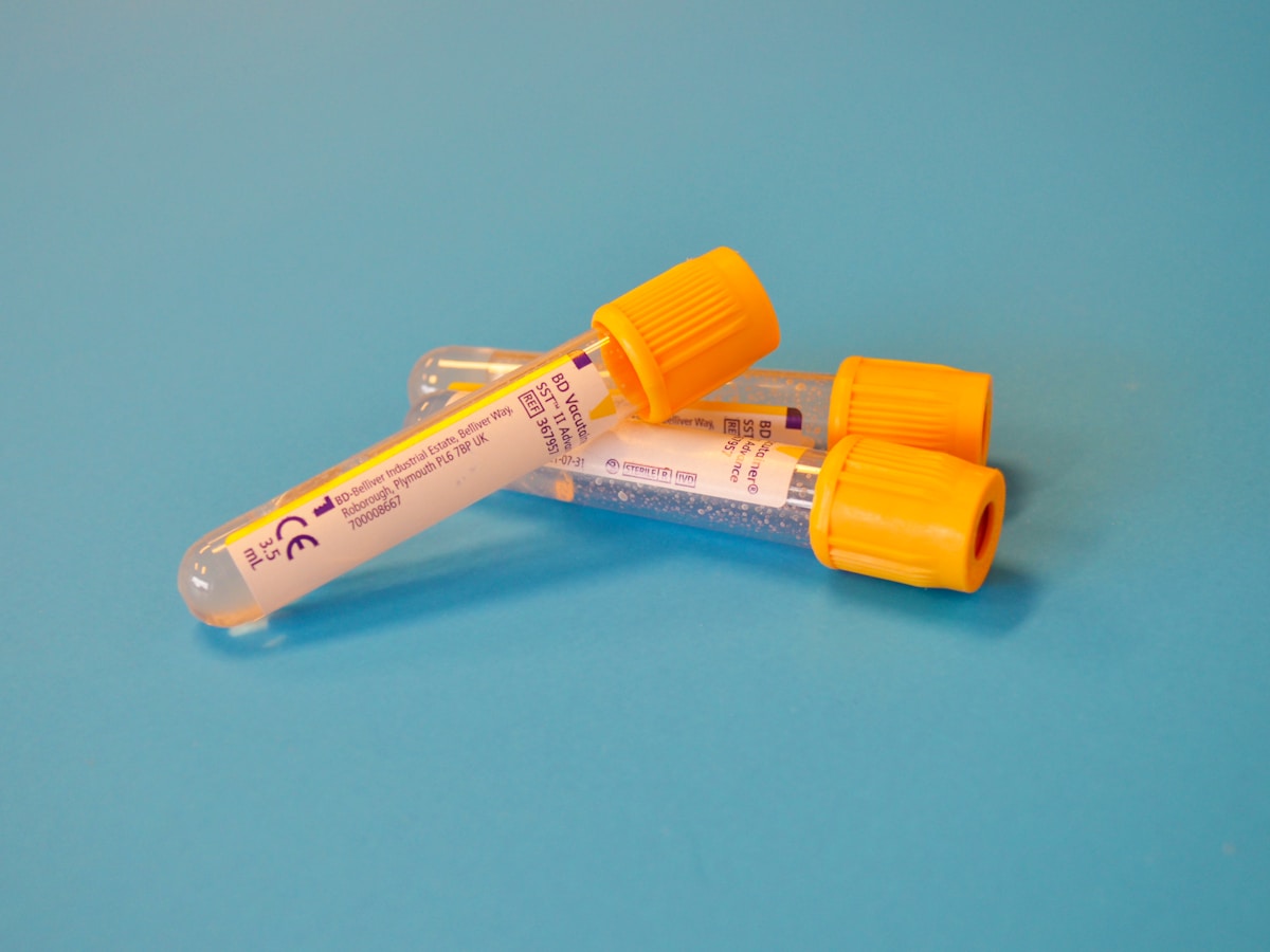 Blood collection tube used for 25-hydroxyvitamin D lab testing.